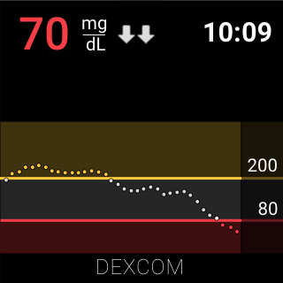 Dexcom G6 screenshot