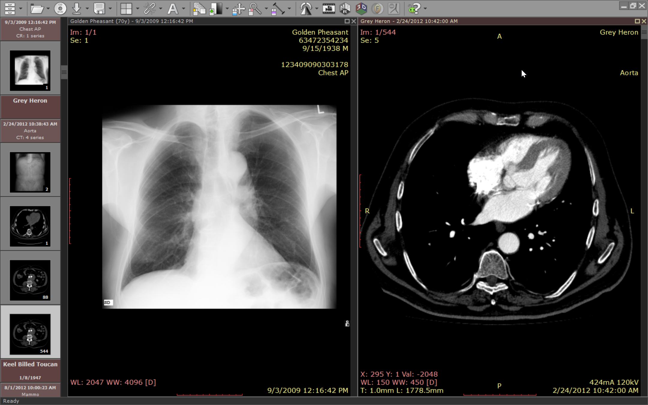 RadiAnt DICOM Viewer screenshot