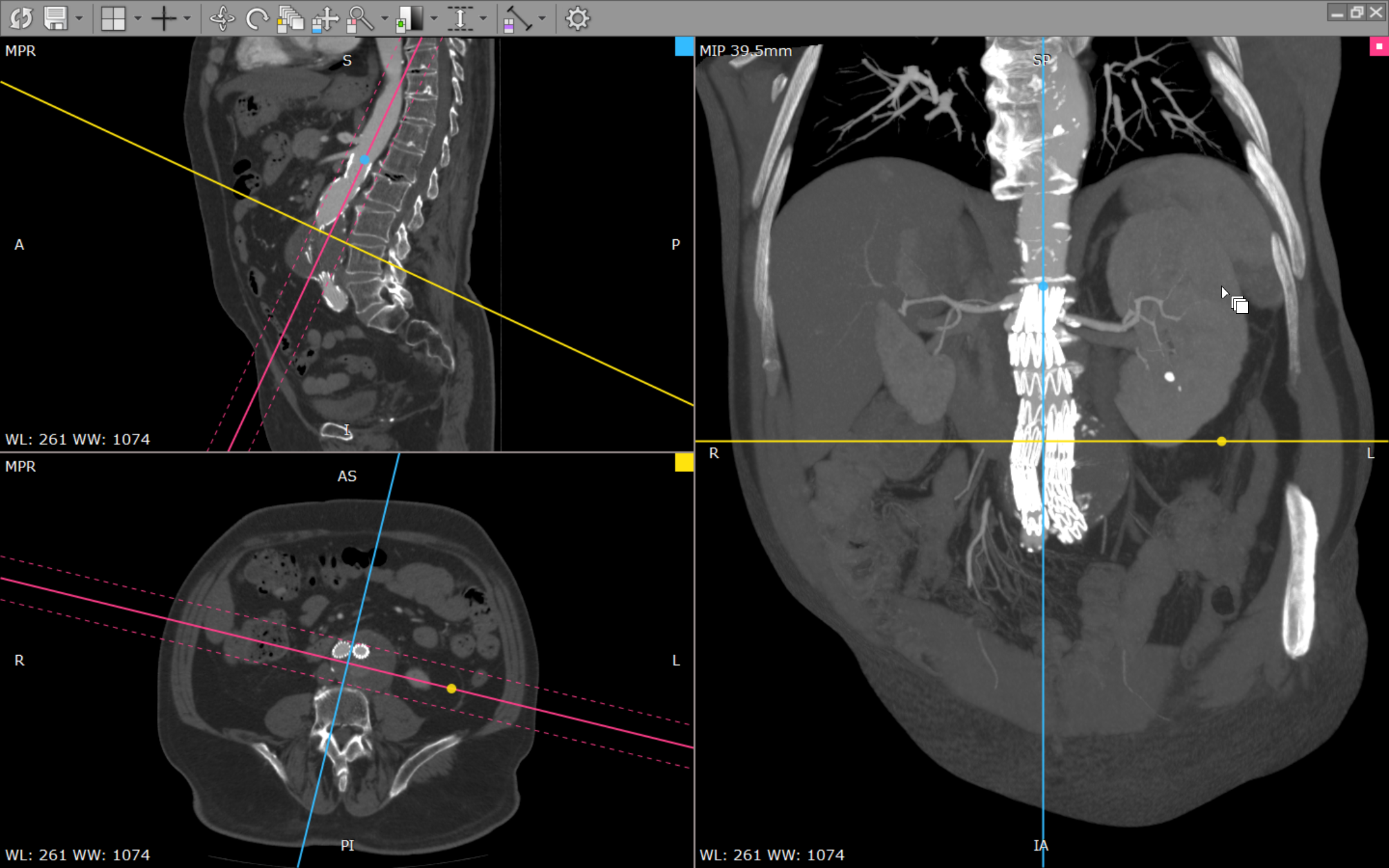 RadiAnt DICOM Viewer screenshot