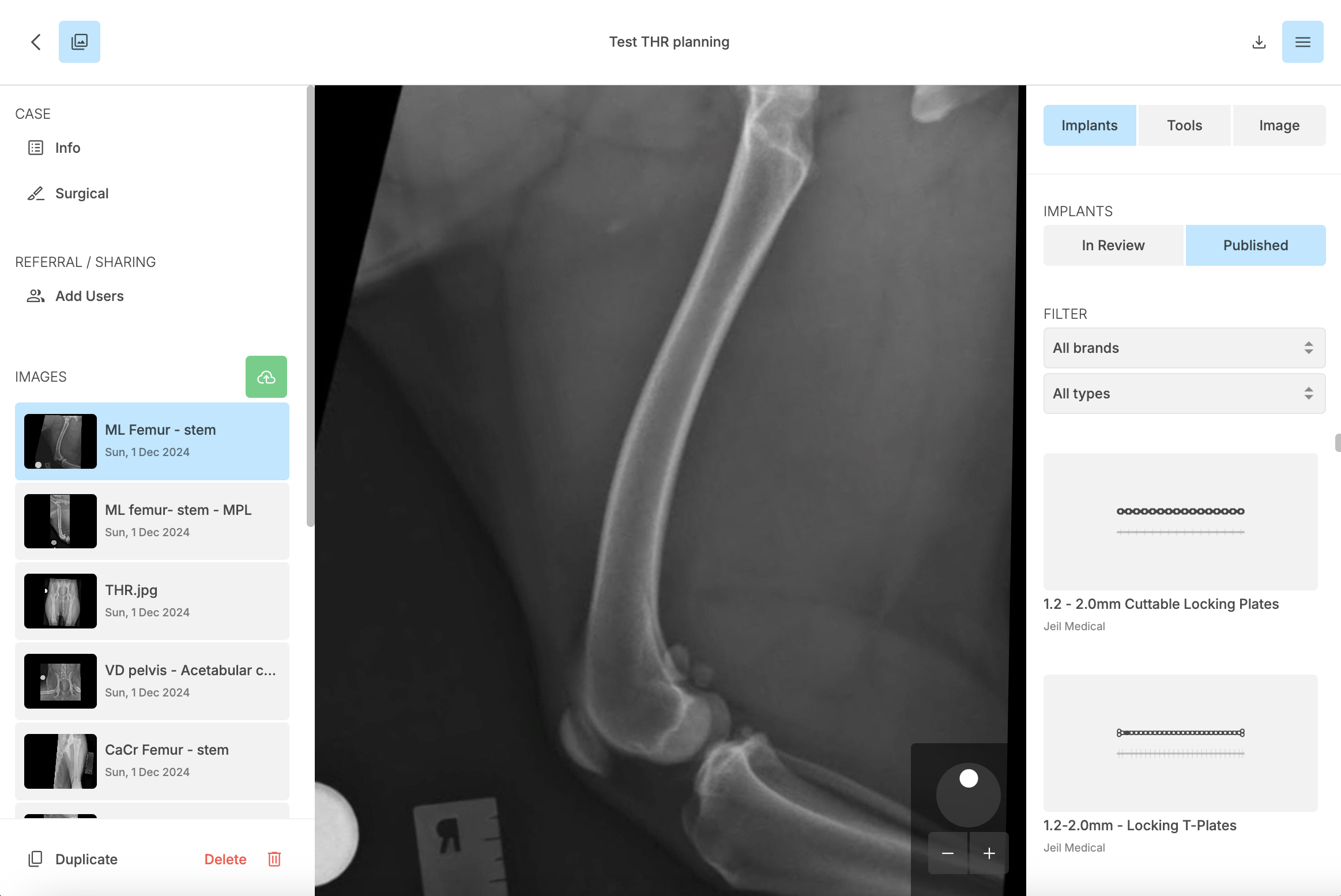 VPOP® PRO screenshot