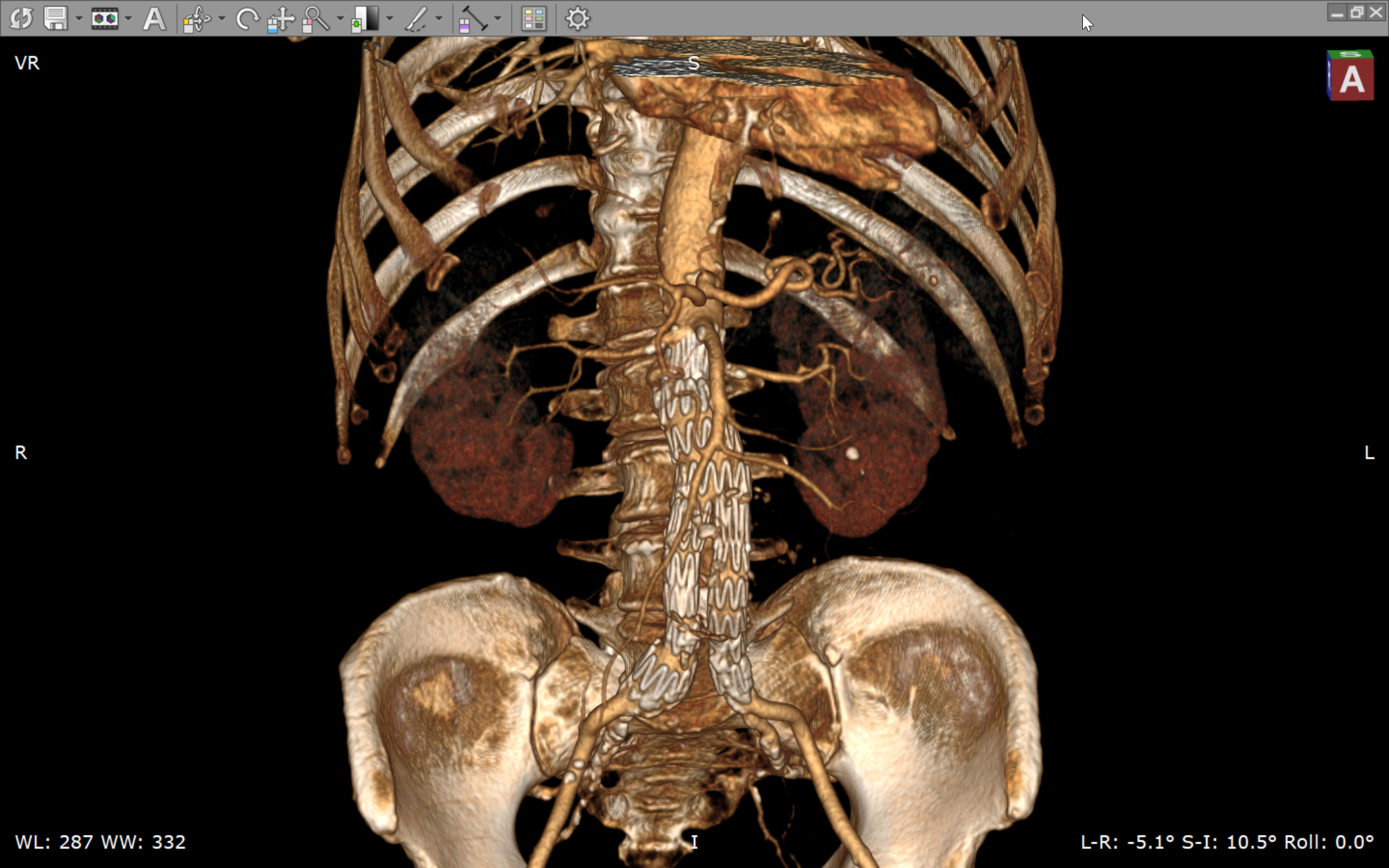 RadiAnt DICOM Viewer screenshot
